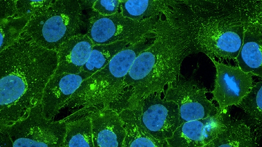 1285011_thumbnail_figure 1 B-high res_512x288.jpg