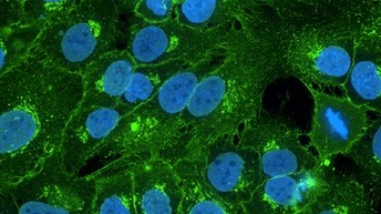 1285011_thumbnail_figure 1 B-high res_512x288.jpg