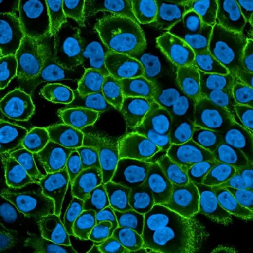 A431 cells stained with PhenoVue Fluor 488 - Donkey Anti-Mouse Antibody Cross-Adsorbed