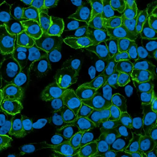A431 cells stained with PhenoVue Fluor 488 - Donkey Anti-Rabbit Antibody Highly Cross-Adsorbed