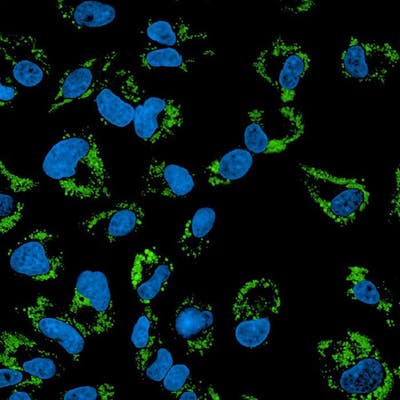 HepG2 cells treated with Oleic Acid-BSA, fixed (PFA), and stained with PhenoVue 493 Lipid Stain (Lipid Droplets, green) + PhenoVue Hoechst 33342 Nuclear Stain (nucleus, blue) (in PBS). Imaged on Operetta CLS.