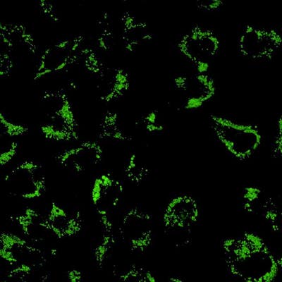 HepG2 cells treated with Oleic Acid-BSA, fixed (PFA), and stained with PhenoVue 493 Lipid Stain (Lipid Droplets, green). Imaged on Operetta CLS.