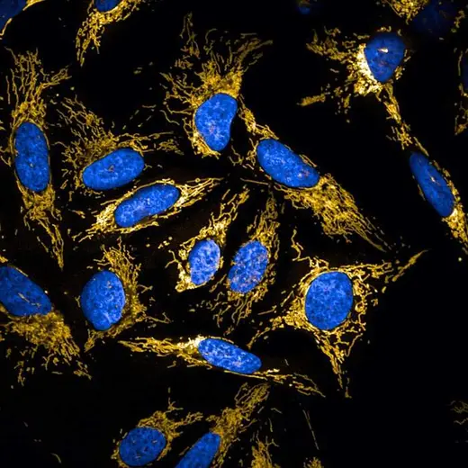 U2OS live cells stained with PhenoVue 551 Mitochondrial Stain (mitochondria, orange) + PhenoVue Hoechst 33342 Nuclear Stain (nucleus, blue). Imaged on Opera Phenix Plus.