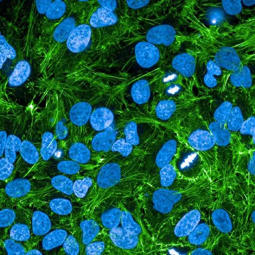 HeLa fixed and permeabilized cells stained with PhenoVue Fluor 488 Phalloidin (actin, green) + PhenoVue Hoechst 33342 Nuclear Stain (nucleus, blue). Imaged on Operetta CLS.
