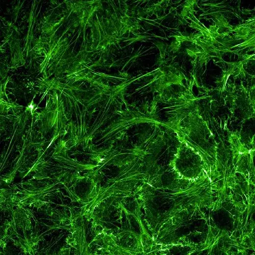 HeLa fixed and permeabilized cells stained with PhenoVue Fluor 488 Phalloidin (actin, green). Imaged on Operetta CLS.