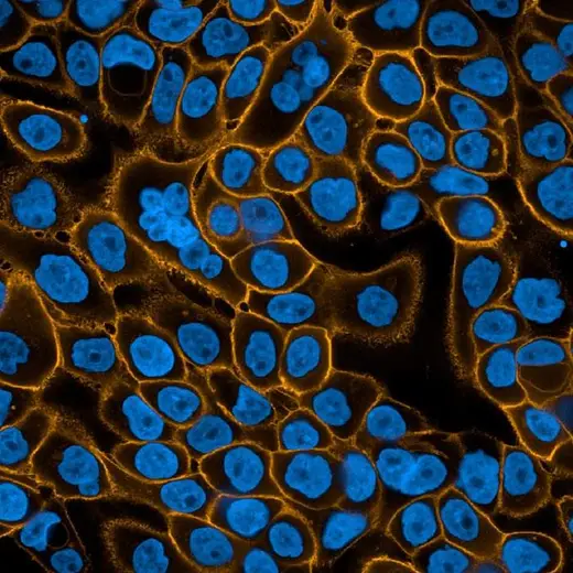 A431 cells fixed and permeabilized, stained with Mouse anti EGFR antibody and PhenoVue Fluor 555 - Goat Anti-Mouse Antibody Highly Cross-Adsorbed (EGFR receptor, orange) + PhenoVue Hoechst 33342 (nucleus, blue). Imaged on Operetta CLS.