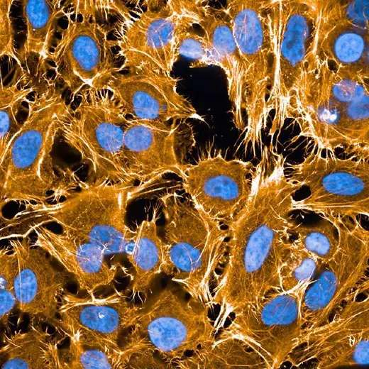 HeLa fixed (PFA) and permeabilized (0.1% Triton X100) cells stained with PhenoVue Fluor 555 Phalloidin (actin, orange) + PhenoVue Hoechst 33342 Nuclear Stain (nucleus, blue). Imaged on Operetta CLS.