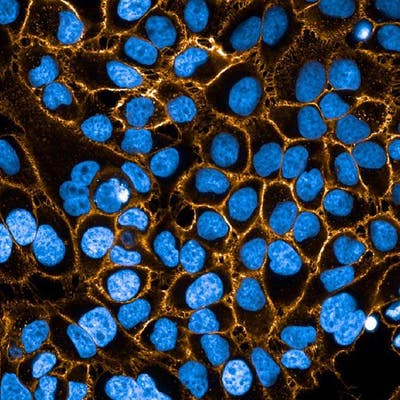 HeLa fixed cells stained with PhenoVue Fluor 555 WGA (Plasma Membrane, orange) + PhenoVue Hoechst 33342 Nuclear Stain (nucleus, blue). Imaged on Operetta CLS.