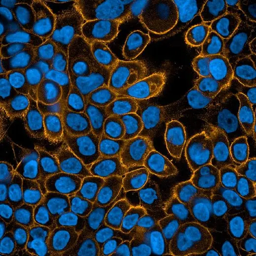 A431 cells fixed and permeabilized, stained with Mouse anti EGFR antibody and PhenoVue Fluor 568 - Goat Anti-Mouse Antibody Highly Cross-Adsorbed (EGFR receptor, orange) + PhenoVue Hoechst 33342 (nucleus, blue). Imaged on Operetta CLS.