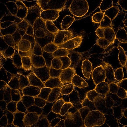 A431 cells fixed and permeabilized, stained with Mouse anti EGFR antibody and PhenoVue Fluor 568 - Goat Anti-Mouse Antibody Highly Cross-Adsorbed (EGFR receptor, orange). Imaged on Operetta CLS.