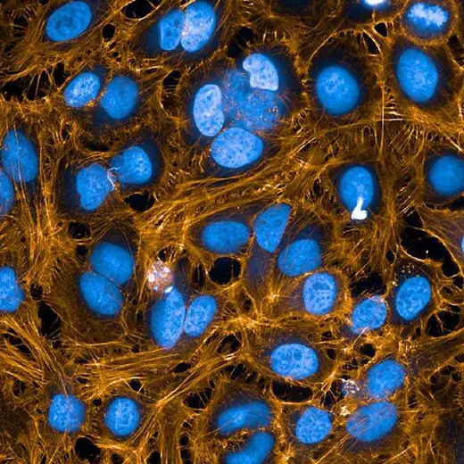 HeLa fixed (PFA) and permeabilized (0.1% Triton X100) cells stained with PhenoVue Fluor 568 Phalloidin (actin, orange) + PhenoVue Hoechst 33342 Nuclear Stain (nucleus, blue). Imaged on Operetta CLS.