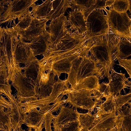 HeLa fixed (PFA) and permeabilized (0.1% Triton X100) cells stained with PhenoVue Fluor 568 Phalloidin (actin, orange). Imaged on Operetta CLS.