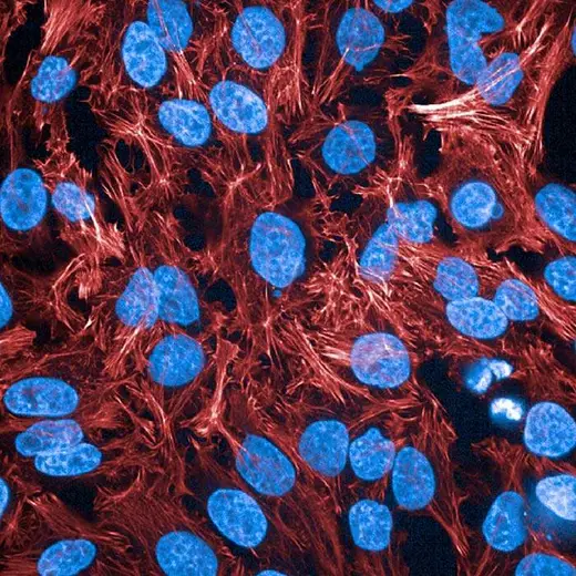 HeLa fixed and permeabilized cells stained with PhenoVue Fluor 647 Phalloidin (actin, red) + PhenoVue Hoechst 33342 Nuclear Stain (nucleus, blue). Imaged on Operetta CLS.