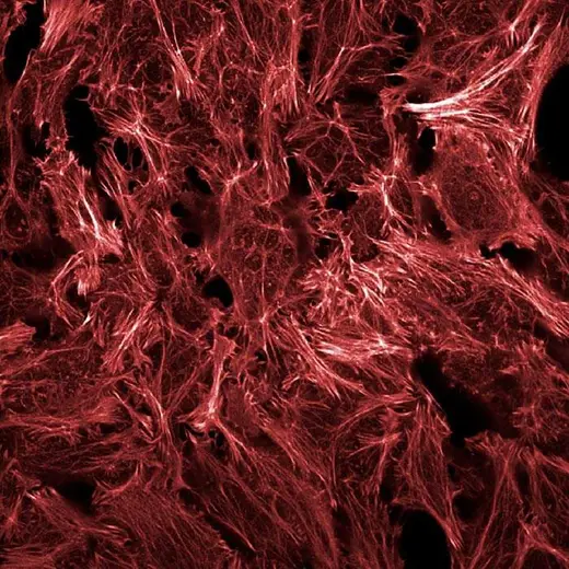 HeLa fixed and permeabilized cells stained with PhenoVue Fluor 647 Phalloidin (actin, red). Imaged on Operetta CLS.