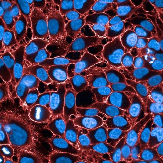 HeLa fixed (PFA) cells stained with PhenoVue Fluor 647 WGA (Plasma Membrane) + PhenoVue Hoechst 33342 Nuclear Stain (nucleus, blue). Imaged on Operetta CLS.