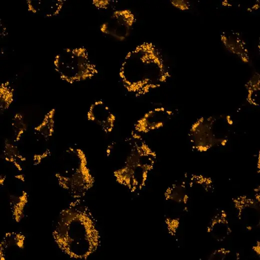HepG2 cells treated with Oleic Acid-BSA then fixed (PFA) and stained with PhenoVue Nile-Red Lipid Stain (Lipid Droplets, orange). Imaged on Operetta CLS.