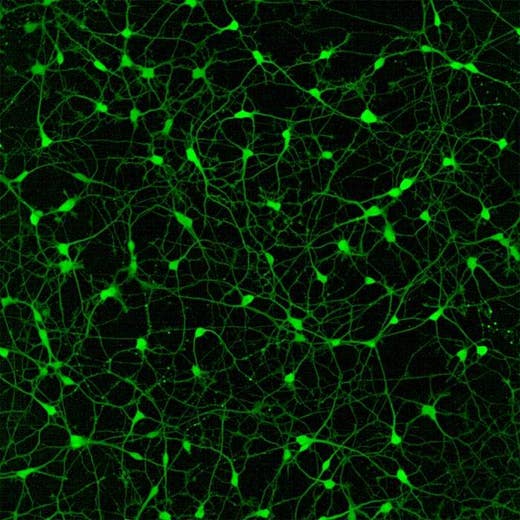 CaFlux Assay iPSC-dervied neurons (nexel) stained with Cal-520 on Opera Phenix Plus (20xW).