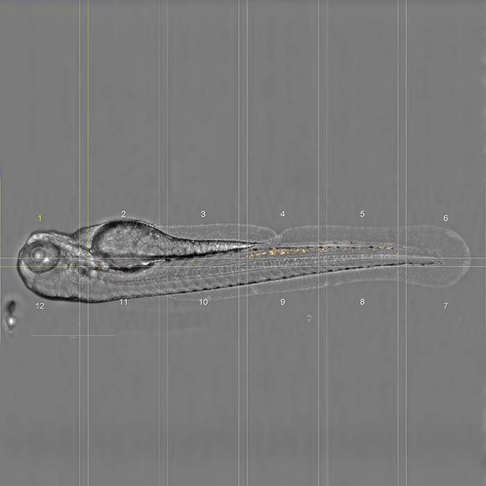 Zebrafish 72hpf - Neutrophils. Lateral positioning on agarose. Imaged by PreciScan on Phenix Plus, 20xAir, Widefield : Brighfield / Ds Red (MIP). Image provided by Institut Pasteur Paris (PBI).