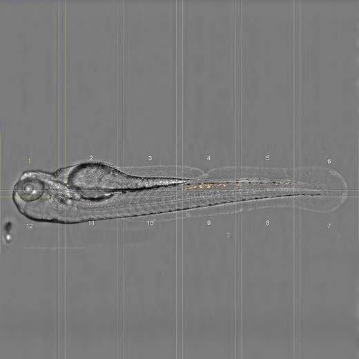 Zebrafish 72hpf – Neutrophils. Lateral positioning on agarose. Imaged by PreciScan on Phenix Plus, 20xAir, Widefield : Brighfield / Ds Red (MIP). Image provided by Institut Pasteur Paris (PBI).