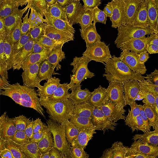 Composite images of HeLa cells (treated with CA74) stained with the PhenoVue Cell Painting Kit. Imaged on Opera Phenix Plus, 40x water immersion objective.