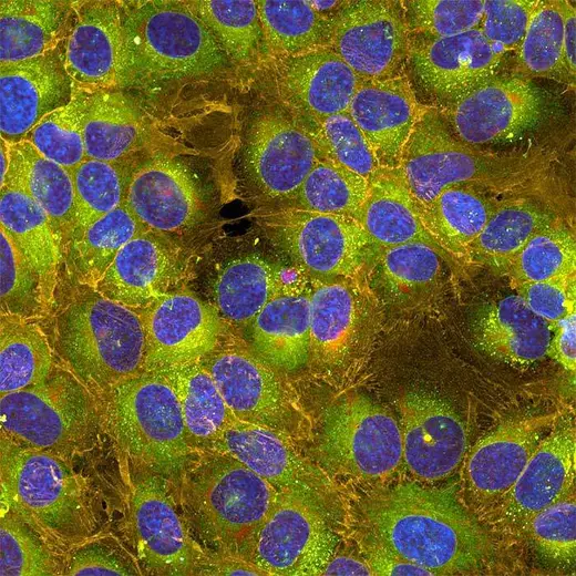Picture of HeLa cells treated with etoposide