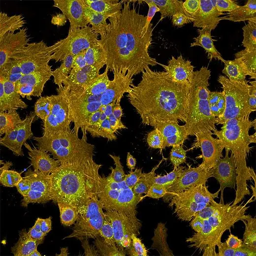 Composite images of HeLa cells (treated with fembendazole) stained with the PhenoVue Cell Painting Kit. Imaged on Opera Phenix Plus, 40x water immersion objective.
