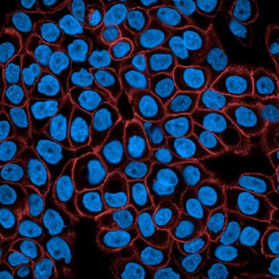 A431 cells stained with PhenoVue Fluor 647 - Donkey Anti-Mouse Antibody Highly Cross-Adsorbed
