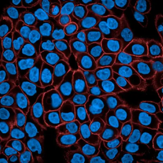 A431 cells stained with PhenoVue Fluor 647 - Donkey Anti-Mouse Antibody Highly Cross-Adsorbed