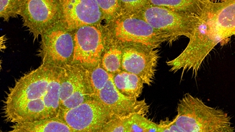 1294648_Cell painting_512x288.jpg