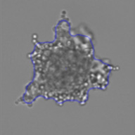 3D spheroid morphological differences 1