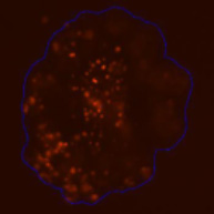 3D spheroid morphological differences 11