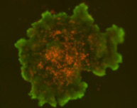 3D spheroid morphological differences 15