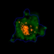 3D spheroid morphological differences 2