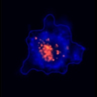 3D spheroid morphological differences 4