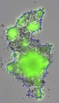  3D spheroid morphological differences 5