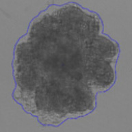 3D spheroid morphological differences 9