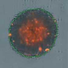 3D tumor spheroid medium drug dose