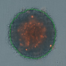 3D tumor spheroids control