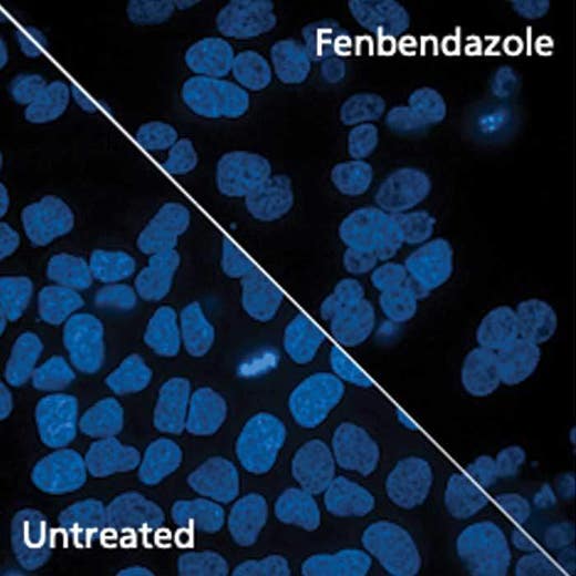 HeLa cells treated or untreated and stained with PhenoVue Cell Painting Kit