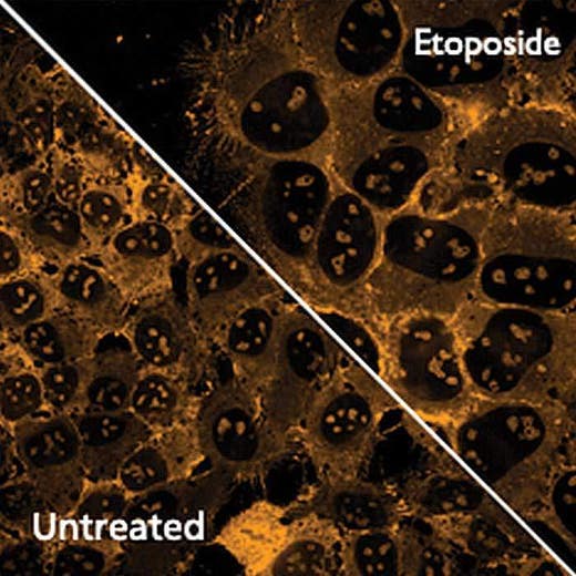 HeLa cells treated or untreated and stained with PhenoVue Cell Painting Kit