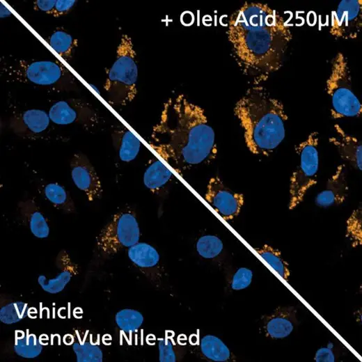 HeLa cells stained with PhenoVue Nile Red