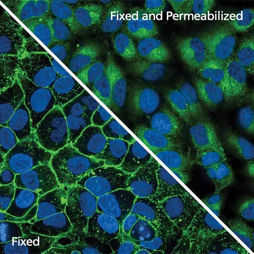 HeLa cells stained with PhenoVue Fluor 488 - Concanavalin A