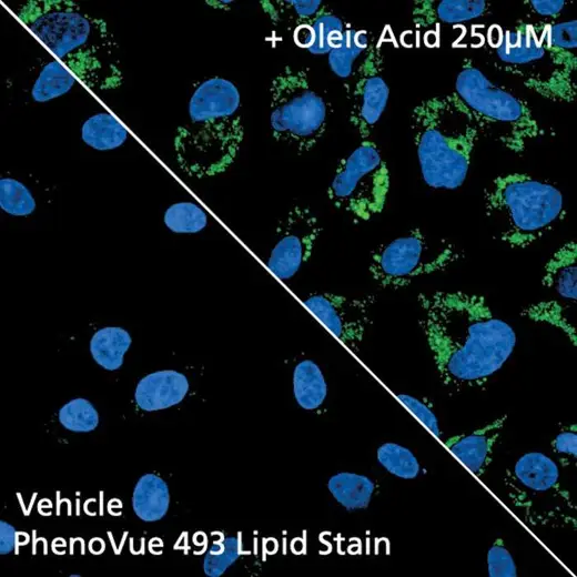 HeLa cells stained with PhenoVue 493 Lipid Stain
