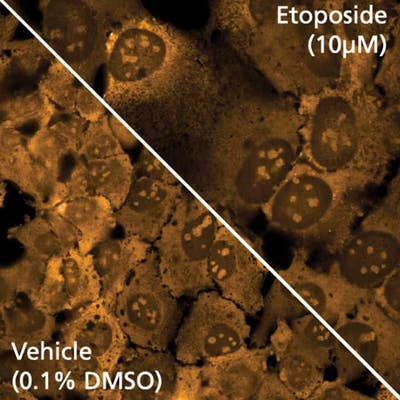 HeLa cells +/- etoposide then stained with PhenoVue 512 Nucleic Acid Stain