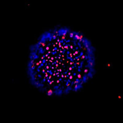 Long-term 3D culture of HepG2 cell spheroid treated with oxaliplatin and co-cultured with DRAQ7