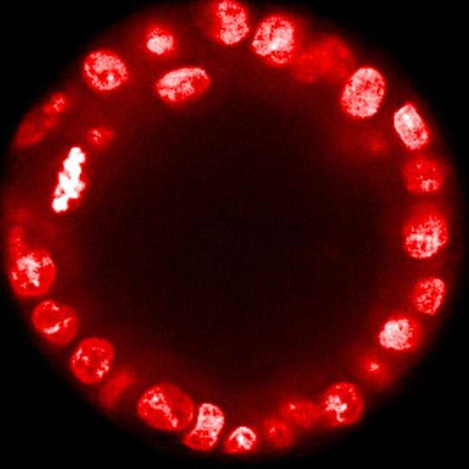 MDCK cyst stained with DRAQ5