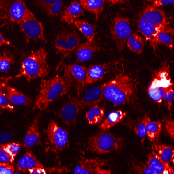 ADME_Cytotox_Mitochondria_Operetta_20xWD-widefield_CellCarrier384-252x252.png