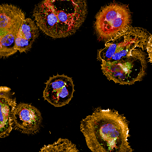 COV434 cells stained with PhenoVue cell painting kit, imaged on Operetta CLS high-content analysis system, 63xW, confocal.