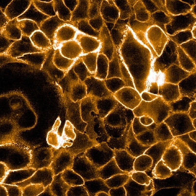 A431 cells incubated with anti EGFR rat IgG2a antibody and PhenoVue Fluor 594-goat anti-rat IgG (H+L) highly cross-adsorbed antibody, imaged on an Operetta CLS HCA system.