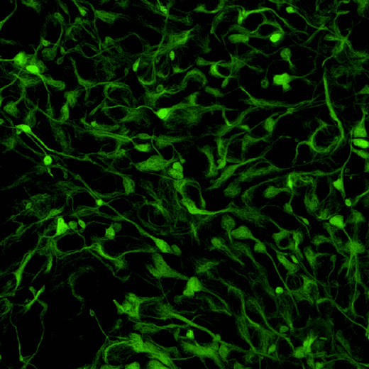 iPSC-derived human cortical neurons stained with anti-Nestin antibody / PhenoVue Fluor 488 secondary